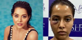 Raiza Wilson’s Face Treatment Goes Wrong