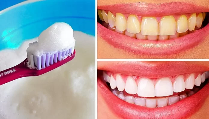 6 Natural Ways To Get White Teeth In 7 Days