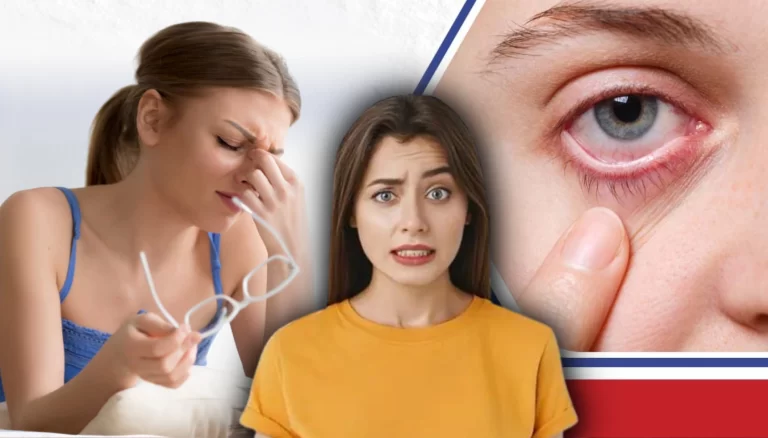 What are the symptoms cure Home Remidies and treatment of conjunctivitis